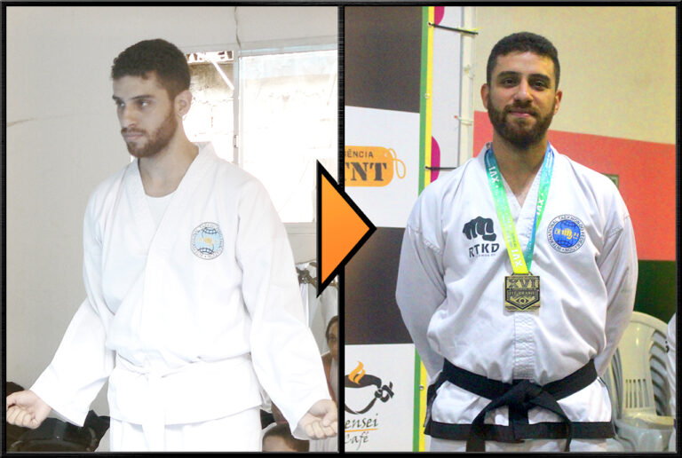 rtkd_site_img_1280x860_galeria_antes-depois_007