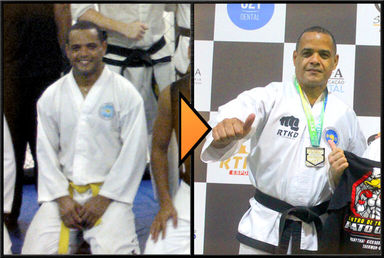 rtkd_site_img_1280x860_galeria_antes-depois_008