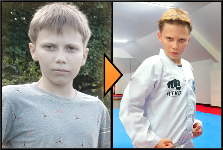 rtkd_site_img_1280x860_galeria_antes-depois_016